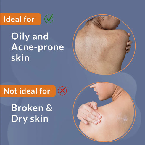 Fixderma Skincare Salyzap Az Body Spray For Acne