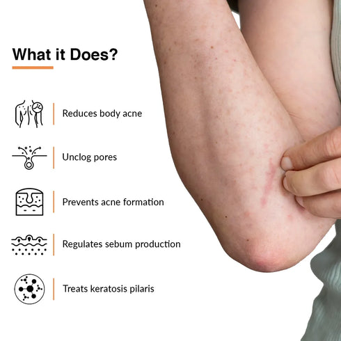 Fixderma Skincare Salyzap Spray For Body Acne