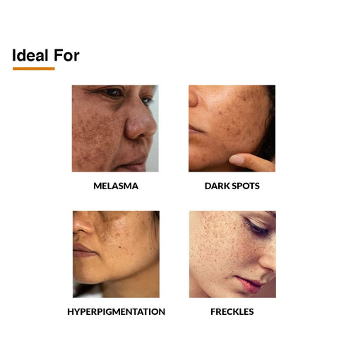 Fixderma Skincare Whitening Cream | Hyperpigmentation And Melasma Treatment
