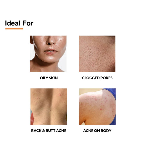 Fixderma Skincare Salyzap Spray For Body Acne