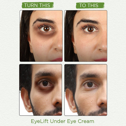 Bella Vita Organic EyeLift Under Eye Cream 20g
