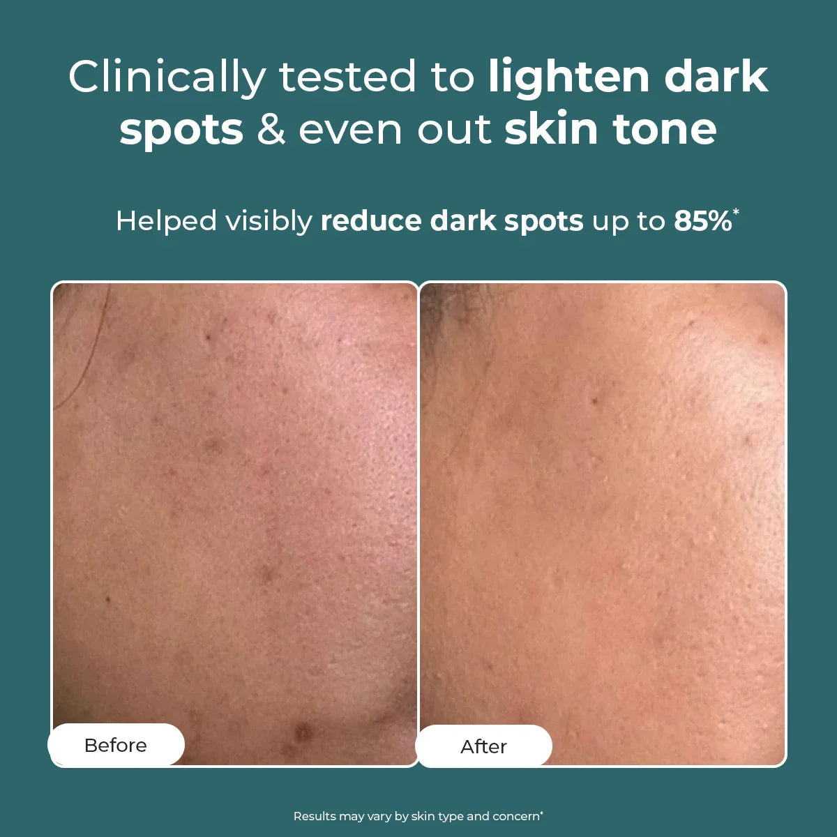 Conscious Chemist Trubiom Pigmentation Corrector Gel Cream 50gm - view 2