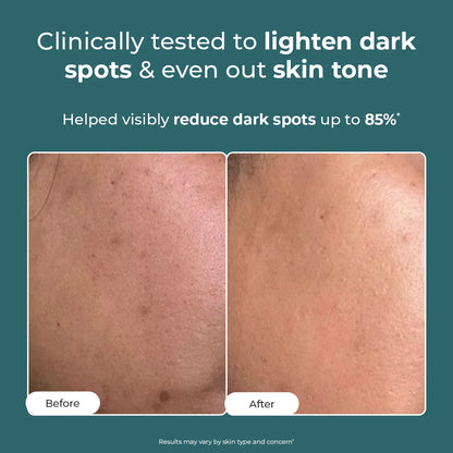 Conscious Chemist Trubiom Pigmentation Corrector Gel Cream 50gm - view 2