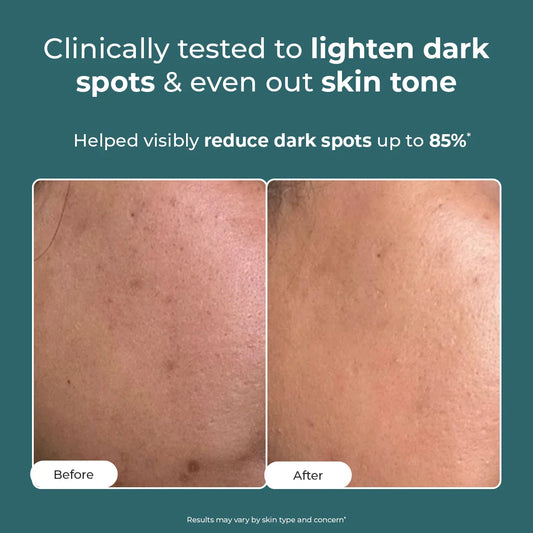 Conscious Chemist Trubiom Pigmentation Corrector Gel Cream 50gm - view 2