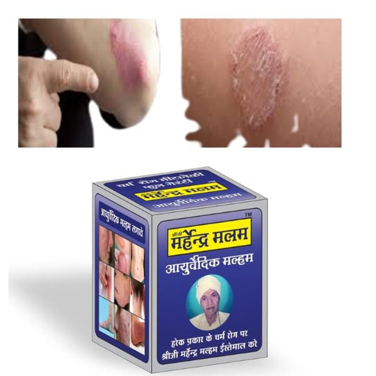 Rahipa Sheeji Mahendra Ayurvedic Anti fungal Malam