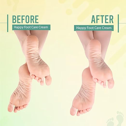 Glamveda Happy Foot Care Crack Cream - PUSHMYCART