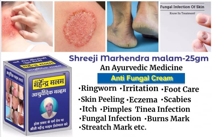 Rahipa Sheeji Mahendra Ayurvedic Anti fungal Malam