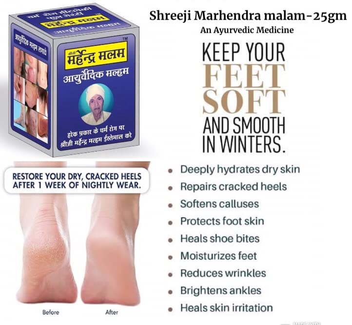 Rahipa Sheeji Mahendra Ayurvedic Anti fungal Malam