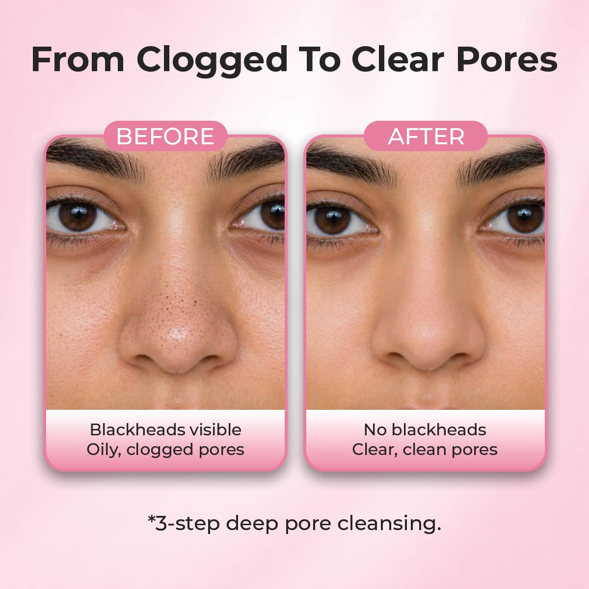 Sanfe Aloe Vera 3 Step Nose Kit