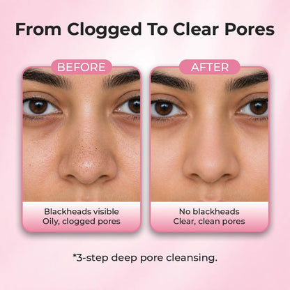Sanfe Aloe Vera 3 Step Nose Kit