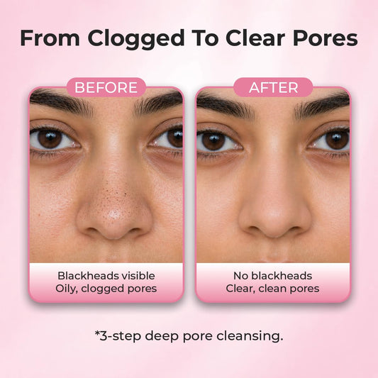 Sanfe Aloe Vera 3 Step Nose Kit