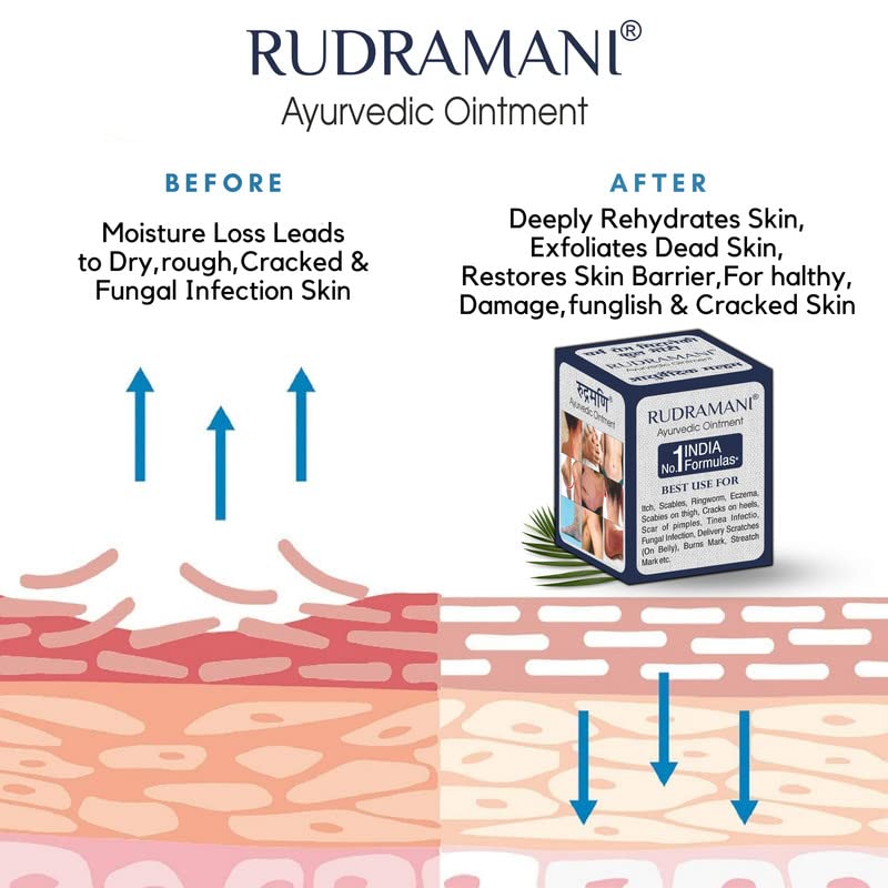 RUDRAMANI Auyrvedic Malam Cream
