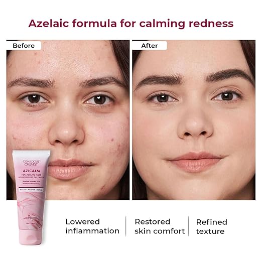 Conscious Chemist® 10% Azelaic Acid Cream | 50g