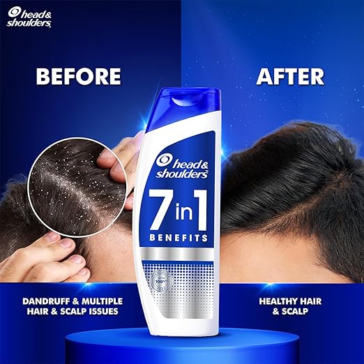 Head & Shoulders 7in1 Anti-Dandruff Shampoo - PUSHMYCART
