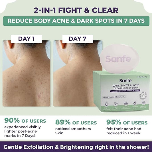 Sanfe Dark Spots|Acne Clearing Body Soap - PUSHMYCART