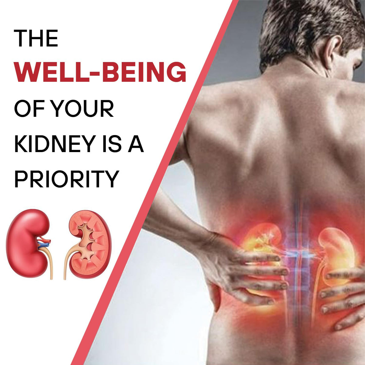 MPIL Nephrol Syrup for dissolving kidney stones and soothing urination discomfort.