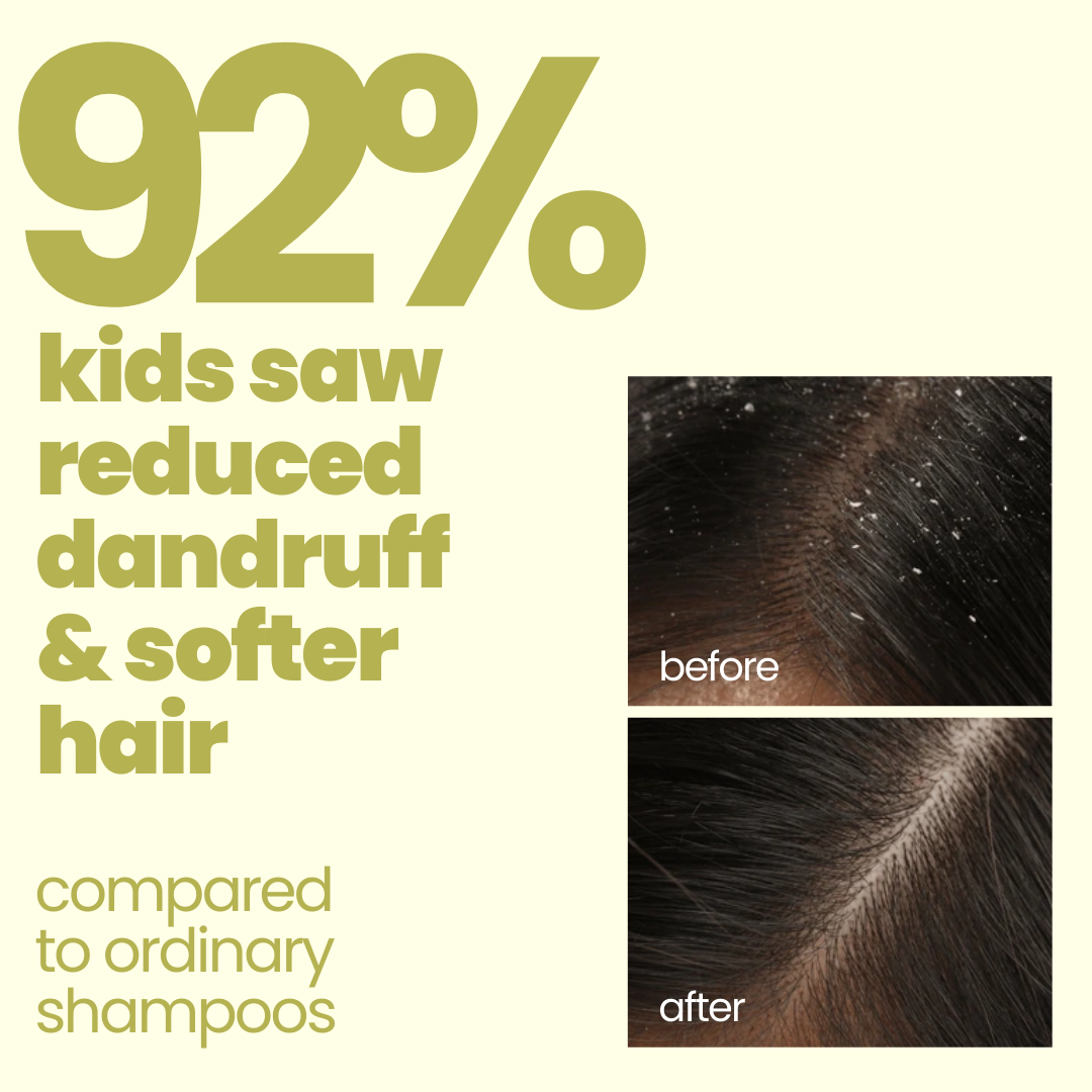Tuco dandruff shampoo for kids