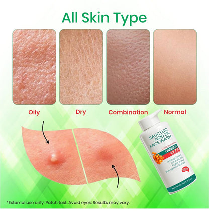 For all skin type