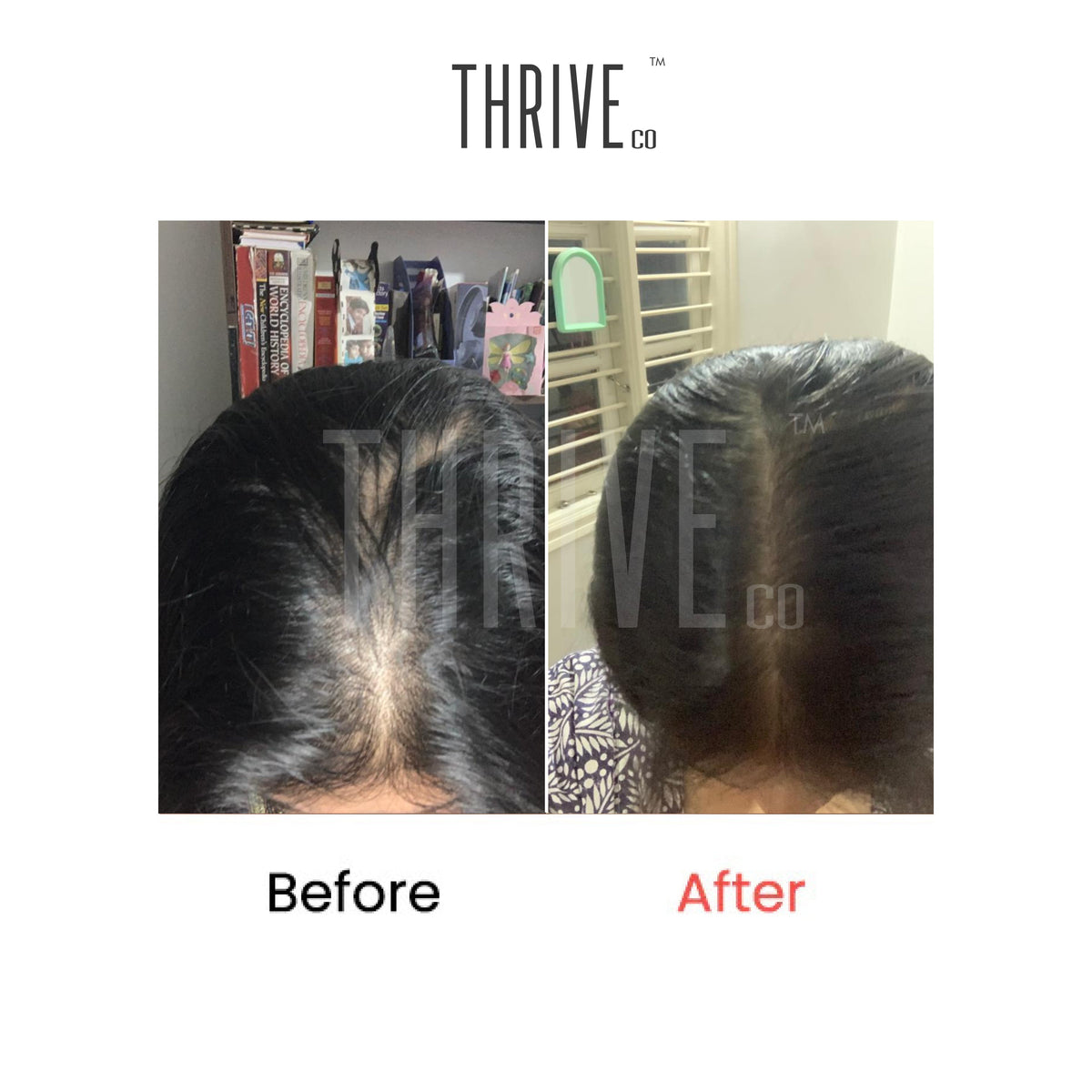 ThriveCo Hair Care Kit featuring Scalp Scrub, Vitalizing Serum, and Hair Growth Serum for healthy hair. - Image 2