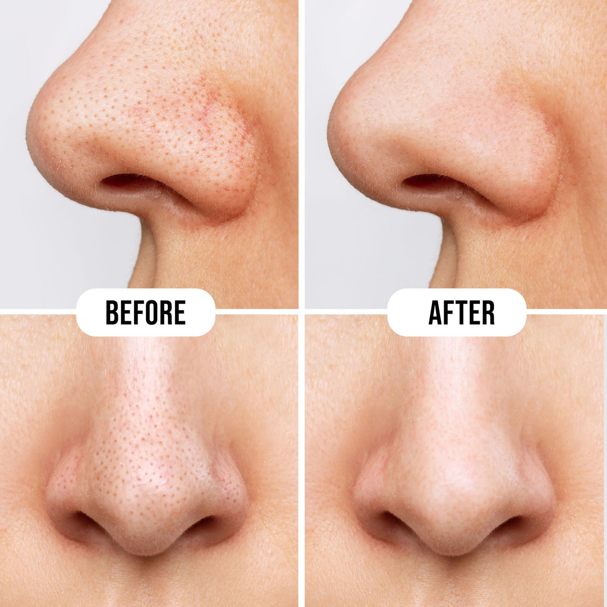 Hilary Rhoda Deep Cleanse Nose Strips - view 6