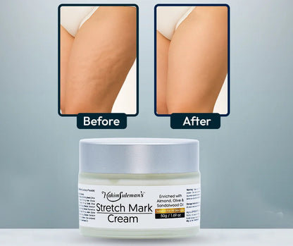 Atiya Herbs Stretch Mark Cream