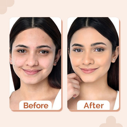 The Derma Co 2% Niacinamide High Coverage Foundation-01 Ivory