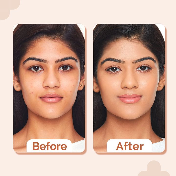 The Derma Co 2% Niacinamide High Coverage Foundation-05 Peach