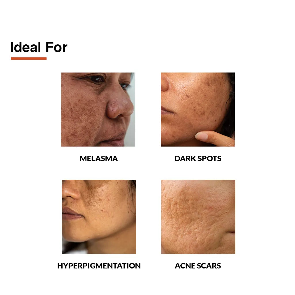 Fixderma Skincare Shadow Spf 70+ Cream