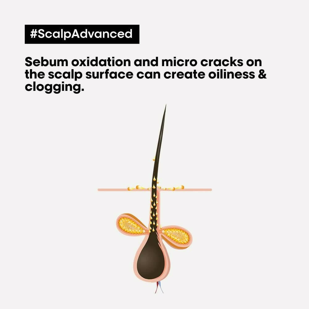 L'Oreal Paris Scalp Advanced Anti-Oiliness 2-In-1 Deep Purifier Clay With 3% AHA - PUSHMYCART